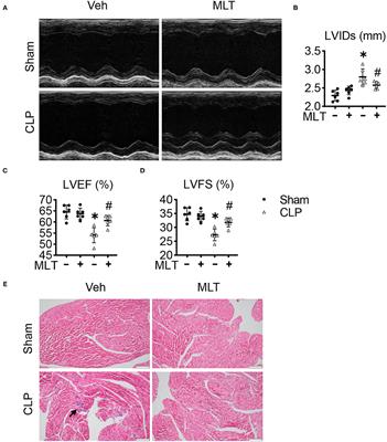 Melatonin Alleviates Cardiac Function in Sepsis-Caused Myocarditis via Maintenance of Mitochondrial Function